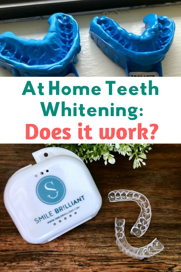 At home teeth whitening does it work? Teeth Whitening for Sensitive Teeth. #sponsored #teethwhitening #dentalhealth #teethwhitener #whiteteeth